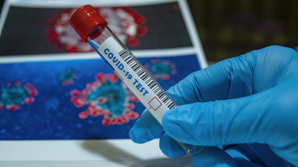 В окупованому Криму зафіксували 7 нових випадків коронавірусу, є один летальний результат