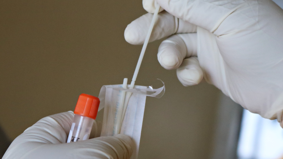 Antirekord: İşğal etilgen Qırımda ve Aqyarda 267 yañı koronavirus hastası qayd etildi